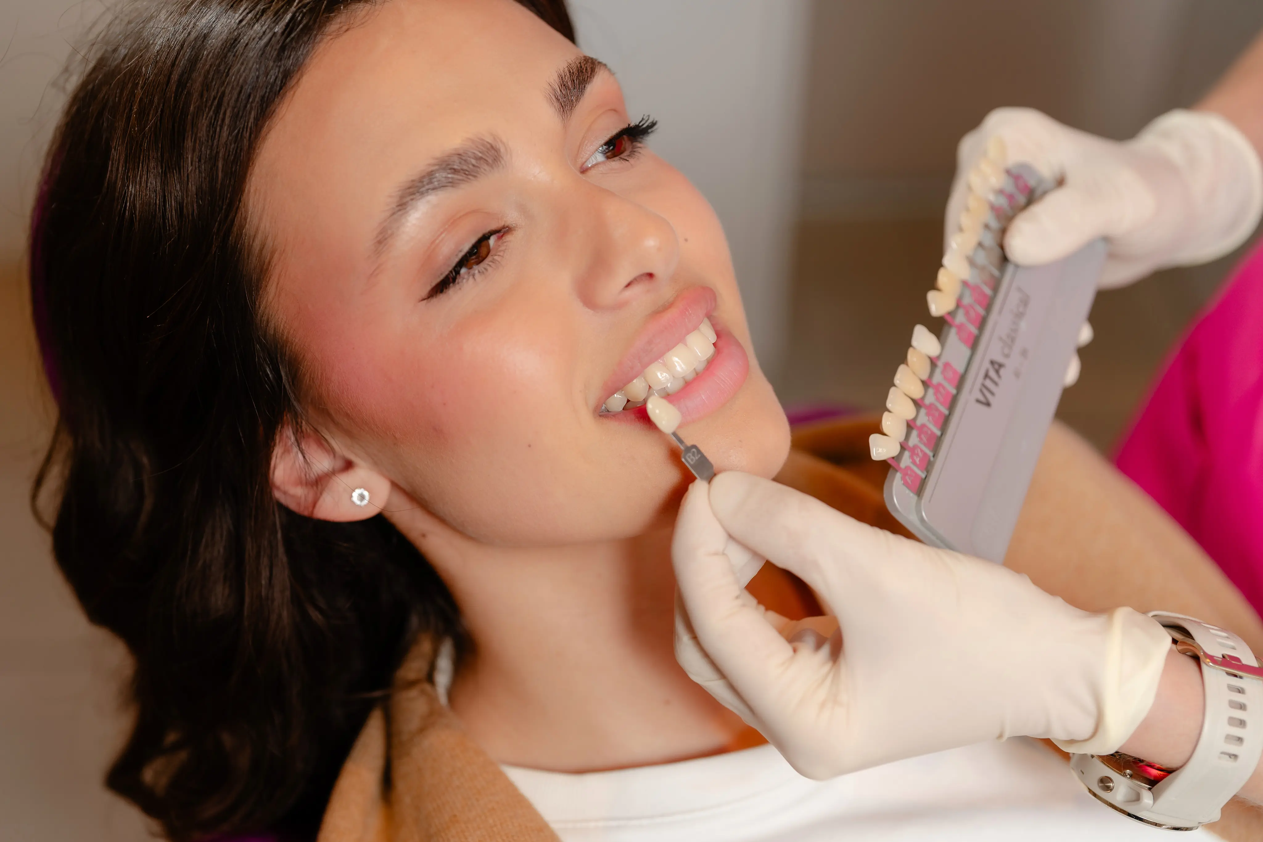 Trattamento con faccette dentali in porcellana presso lo Studio Dentistico Martellacci a Pisa.